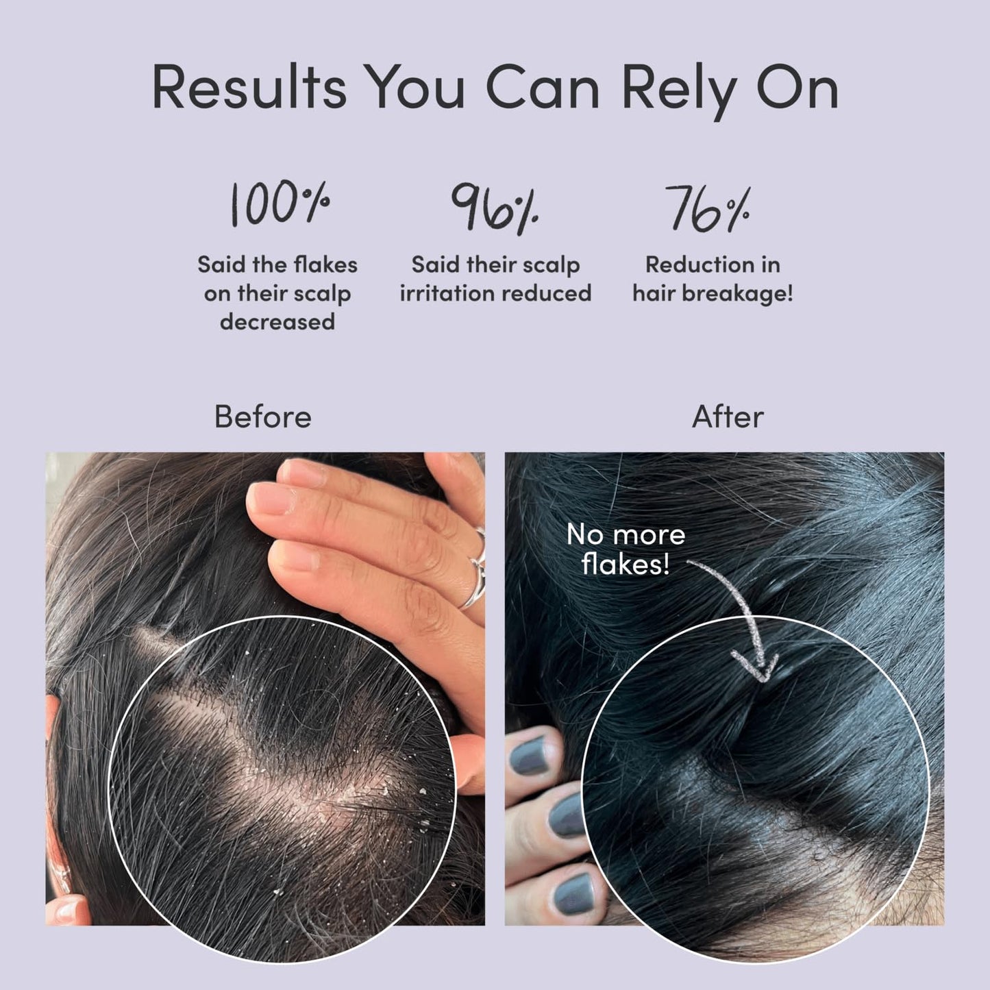 Jupiter Anti-Dandruff Shampoo, Conditioner, & Serum Advanced Set, Physician-Formulated for Dry, Itchy, Oily, Flaky Scalp Care, Color-Safe, Dry Scalp, Sulfate-Free