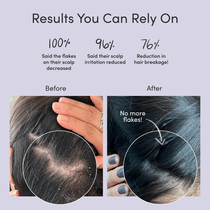 Jupiter Anti-Dandruff Shampoo, Conditioner, & Serum Advanced Set, Physician-Formulated for Dry, Itchy, Oily, Flaky Scalp Care, Color-Safe, Dry Scalp, Sulfate-Free