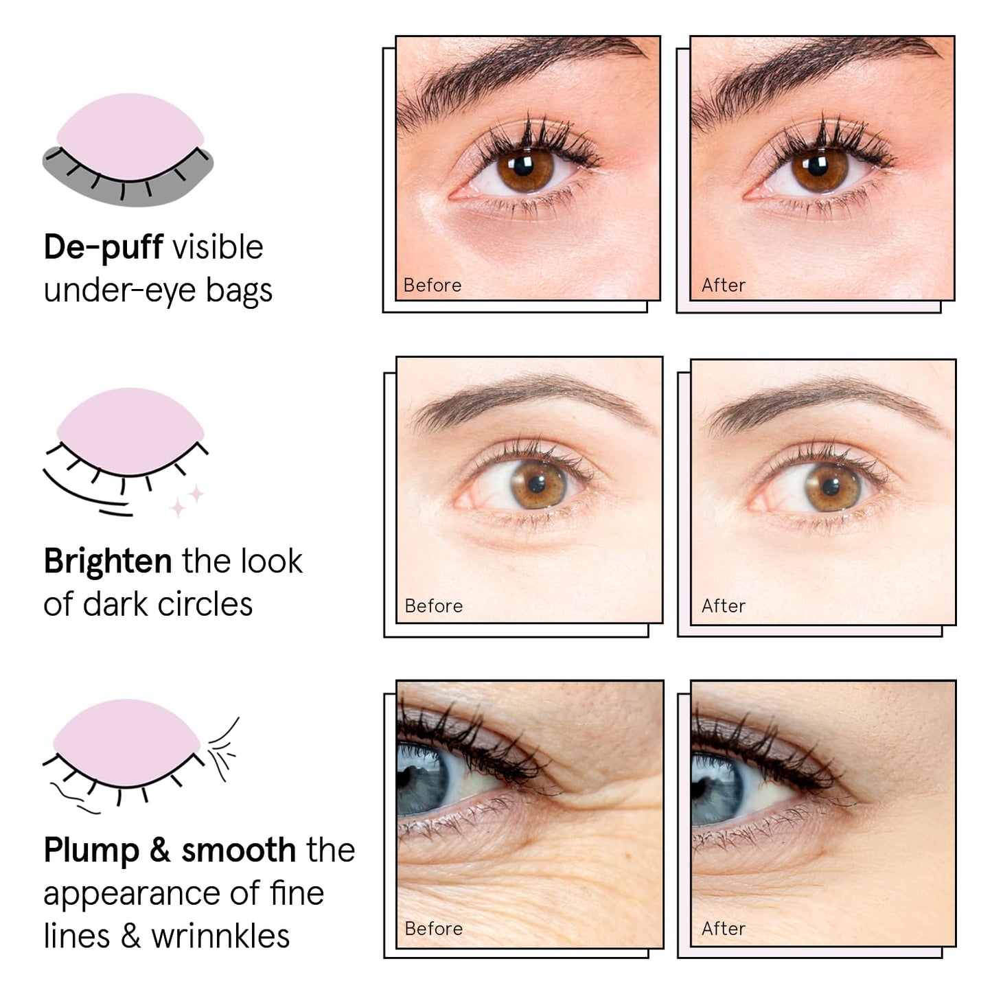 grace & stella Under Eye Patches (12 pairs) Eye Masks for Dark Circles and Puffiness - Birthday Gifts for Women, Bachelorette Party Favors, Bridesmaid Proposal Gifts, Self Care, Spa, Relaxation, Vegan