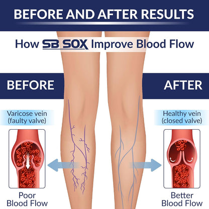 SB SOX Compression Socks for Men & Women (20-30 mmHg) - Best Support Stockings for Travel, Medical, and Sports - Perfect for Everyday Wear