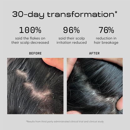 Jupiter Balancing Anti Dandruff Shampoo Duo, for Women & Men, Physician-Formulated for Flaky, Itchy, Oily, Dry Scalp, & Paraben-Free, Anti-Dandruff Shampoo with Zinc, 2 pack, 14 fl oz ea